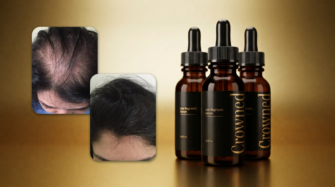 The Crowned three-bottle kit beside before and after photos of the crown